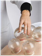 Cupping
